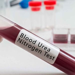 Blood Urea