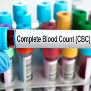 Complete Blood Count