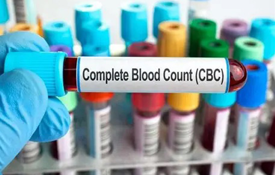 Complete Blood Count