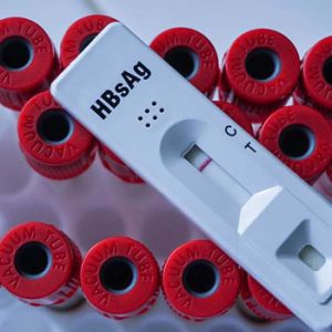 HBsAg