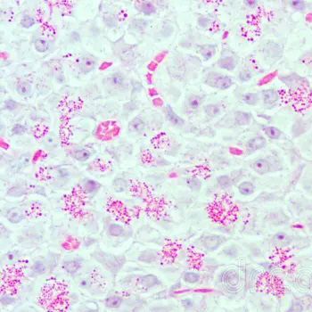 Histopathology 222microscope tissue slide Histopathology 222microscope tissue slide