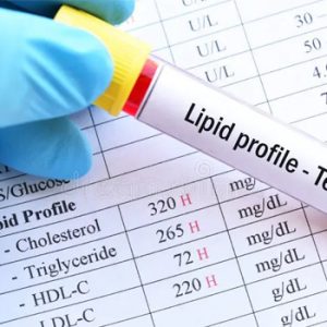 Lipid Profile