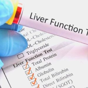 Liver Function Test