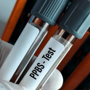 Post Prandial Blood Sugar (PPBS)