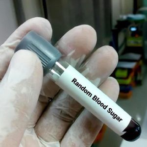 Random Blood Sugar