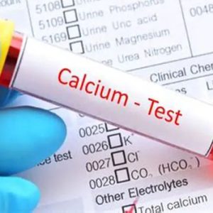 Serum Calcium