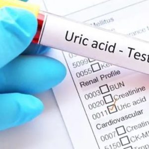 Uric Acid