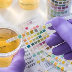 Urine Analysis