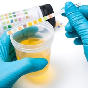 Urine Analysis