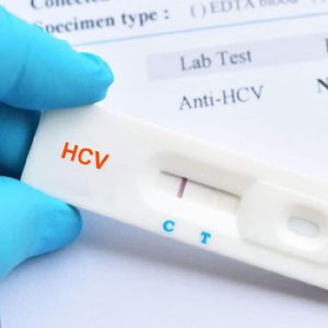 HCV