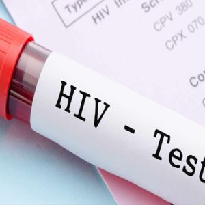 HIV