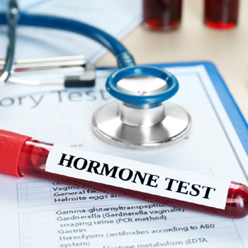 hormno2222e hormno2222e