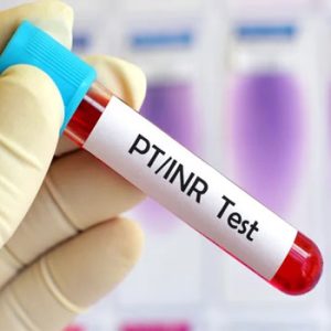 PT INR