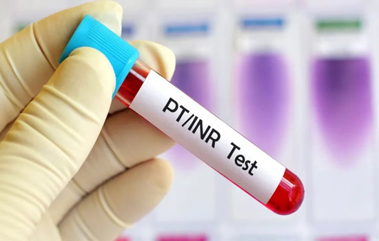 PT INR