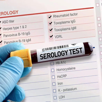 serology222 serology222