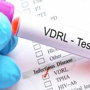 VDRL